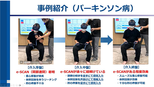 mediVRの事例キャプチャ